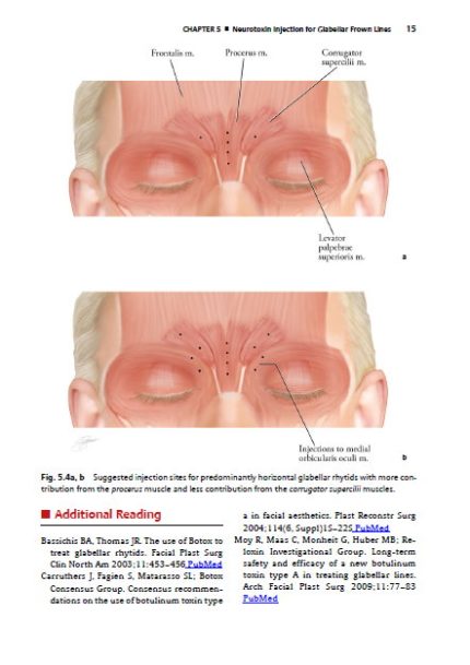 Cosmetic Injection Techniques